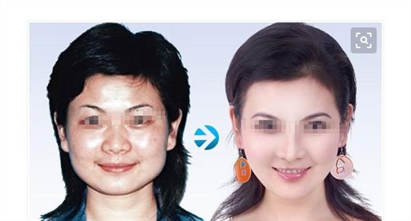 彩光<a href=http://www.bolangguoji.com/listinfo-770-0.html target=_blank class=infotextkey>嫩膚</a>手術的優點有哪些呢