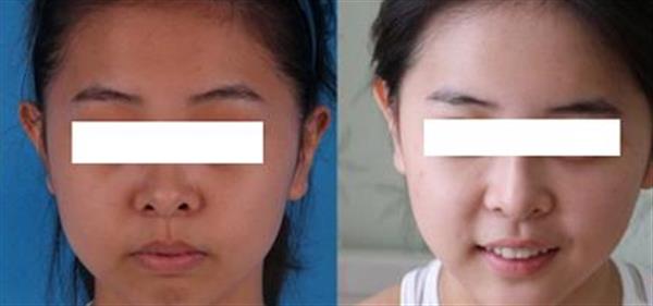 彩光<a href=http://www.bolangguoji.com/listinfo-770-0.html target=_blank class=infotextkey>嫩膚</a>手術價格是多少