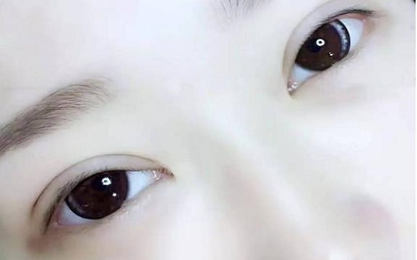 杭州單眼皮做<a href=http://www.bolangguoji.com/listinfo-724-0.html target=_blank class=infotextkey>雙眼皮</a>價格