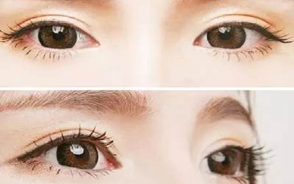 杭州眼部<a href=http://www.bolangguoji.com/listinfo-4-0.html target=_blank class=infotextkey>整形醫(yī)院</a>哪兒好