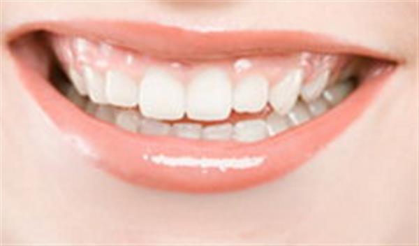<a href=http://www.bolangguoji.com/listinfo-825-0.html target=_blank class=infotextkey>牙齒種植</a>與假牙的區別
