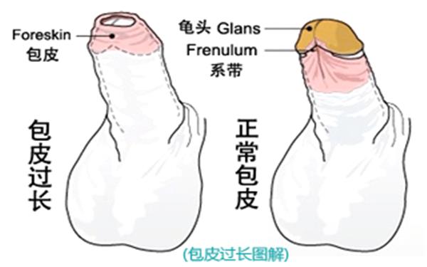 包皮手術(shù)要多少錢