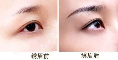 眉部美容<a href=http://www.bolangguoji.com/listinfo-657-0.html target=_blank class=infotextkey>繡眉</a>大概需要多少錢