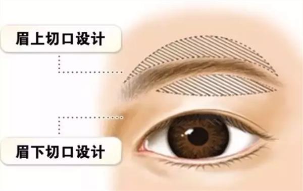 提眉和<a href=http://www.bolangguoji.com/listinfo-655-0.html target=_blank class=infotextkey>切眉</a>的區別