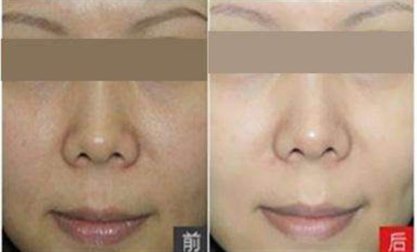 彩光<a href=http://www.bolangguoji.com/listinfo-770-0.html target=_blank class=infotextkey>嫩膚</a>美容有哪些好處