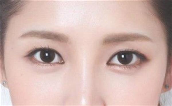 韓式<a href=http://www.bolangguoji.com/listinfo-714-0.html target=_blank class=infotextkey>紋眼線</a>恢復時間