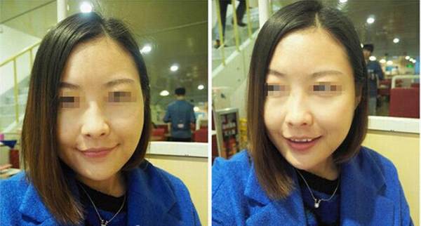 哪些人群不適合做光子<a href=http://www.bolangguoji.com/listinfo-770-0.html target=_blank class=infotextkey>嫩膚</a>呢