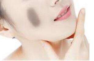 C6激光<a href=http://www.bolangguoji.com/listinfo-773-0.html target=_blank class=infotextkey>去胎記</a>效果好嗎