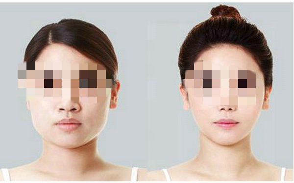 打<a href=http://www.bolangguoji.com/listinfo-734-0.html target=_blank class=infotextkey>愛貝芙</a>有什么危害？