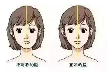 大小臉嚴重怎么調整