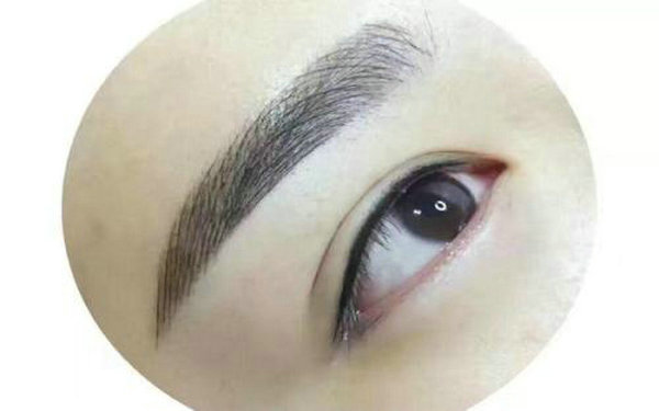 提眉術的缺點