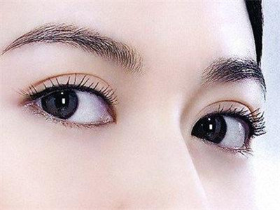 韓式重瞼術(shù)的效果好嗎?