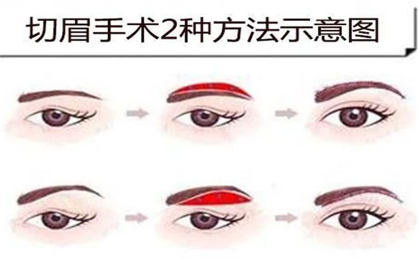 哪些人適合做<a href=http://www.bolangguoji.com/listinfo-655-0.html target=_blank class=infotextkey>切眉</a>術呢？