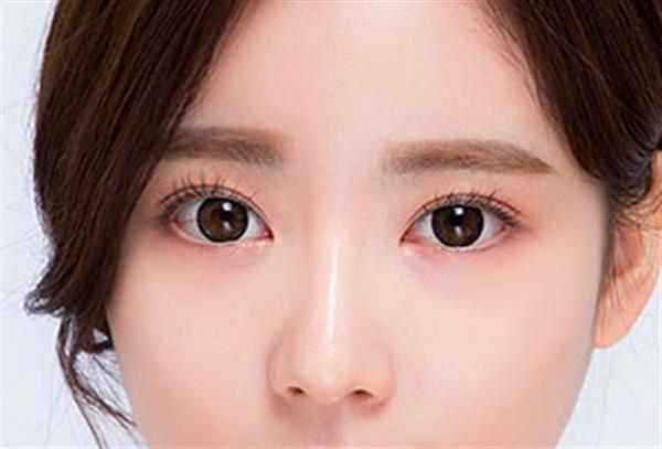 微創<a href=http://www.bolangguoji.com/listinfo-724-0.html target=_blank class=infotextkey>雙眼皮</a>怎樣恢復快