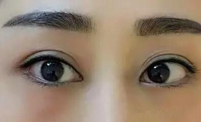 紋過<a href=http://www.bolangguoji.com/listinfo-705-0.html target=_blank class=infotextkey>美瞳線</a>后注意事項