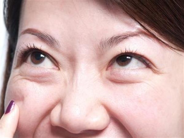 熱熔<a href=http://www.bolangguoji.com/listinfo-708-0.html target=_blank class=infotextkey>去眼袋</a>疼嗎