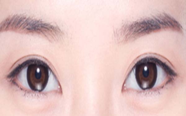 手術<a href=http://www.bolangguoji.com/listinfo-708-0.html target=_blank class=infotextkey>去眼袋</a>要多少錢