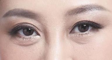 涂什么可以<a href=http://www.bolangguoji.com/listinfo-708-0.html target=_blank class=infotextkey>去眼袋</a>