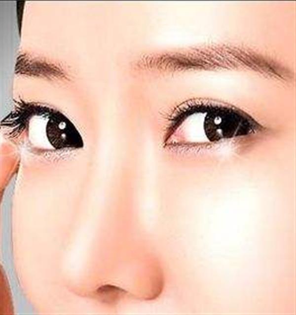 摩皺<a href=http://www.bolangguoji.com/listinfo-708-0.html target=_blank class=infotextkey>去眼袋</a>效果好嗎