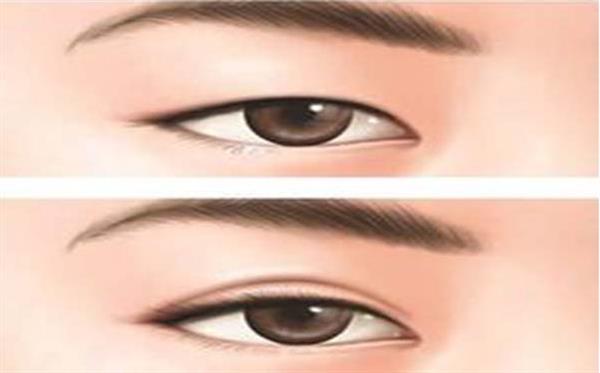 埋線<a href=http://www.bolangguoji.com/listinfo-724-0.html target=_blank class=infotextkey>雙眼皮</a>多少
