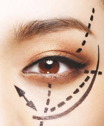割<a href=http://www.bolangguoji.com/listinfo-724-0.html target=_blank class=infotextkey>雙眼皮</a>會引起臉腫嗎