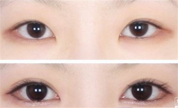 埋線法做<a href=http://www.bolangguoji.com/listinfo-724-0.html target=_blank class=infotextkey>雙眼皮</a>多少錢