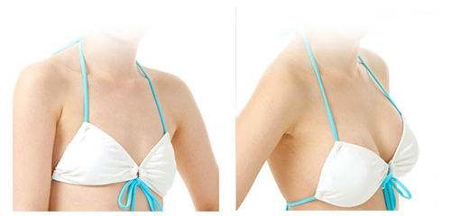 假體<a href=http://www.bolangguoji.com/listinfo-618-0.html target=_blank class=infotextkey>隆胸</a>后可以哺乳嗎