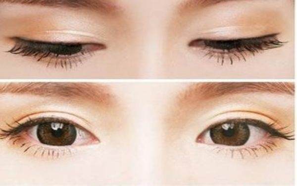 韓美切<a href=http://www.bolangguoji.com/listinfo-724-0.html target=_blank class=infotextkey>雙眼皮</a>多少錢