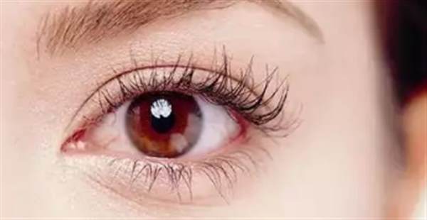 <a href=http://www.bolangguoji.com/listinfo-724-0.html target=_blank class=infotextkey>雙眼皮</a>怎么消腫快