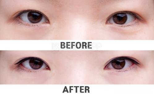 長期眼線多少錢